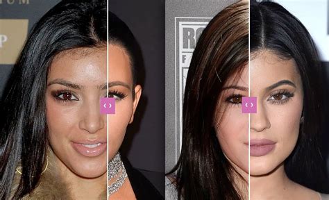 Kim Kardashian Before And After Plastic Surgery Pics