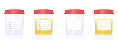 Free Urine Sample Clipart In Ai Svg Eps Or Psd
