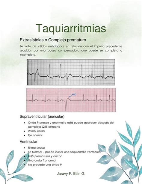 Taquiarritmias Medilove Udocz