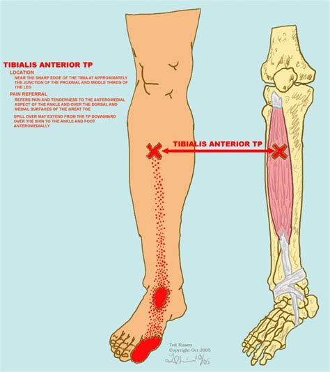 Muscle Tests Illustrations Foot Pain Chart Ankle Exercises Cardiac