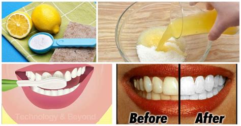 Natural Ways To Whiten Your Teeth At Home Neopress
