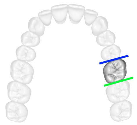 Teeth Surfaces Dental Terminology Web Dmd