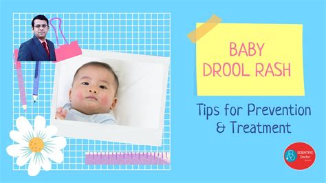 Drool Rash In Babies Tips On Prevention And Treatment Youtube
