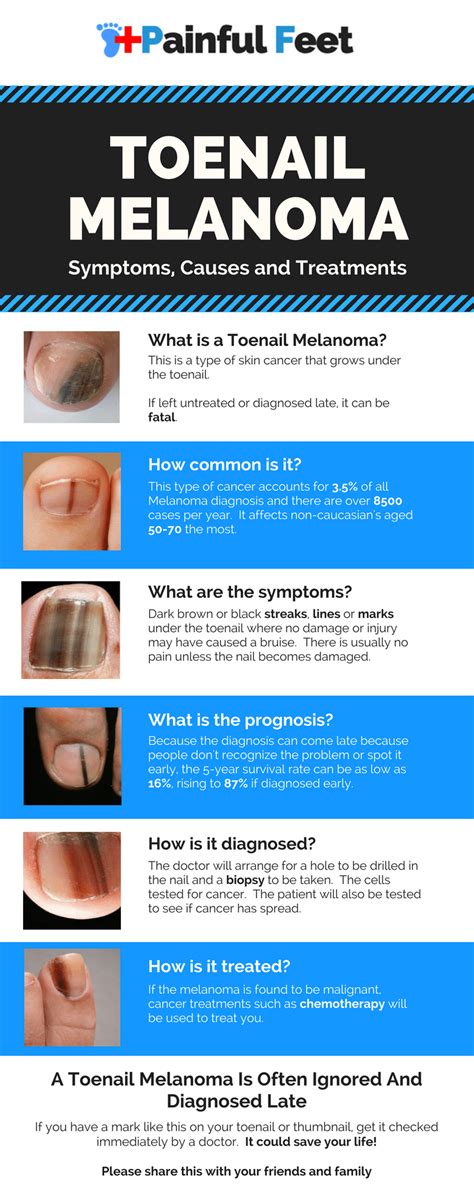 How To Tell If You Have A Toenail Melanoma Painful Feet