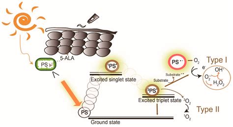 Daylight Photodynamic Therapy Encyclopedia Mdpi