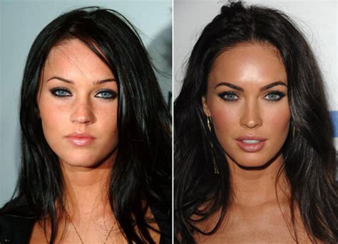 15 Celebrities Transformed By Plastic Surgery Page 2 Of 12 Check