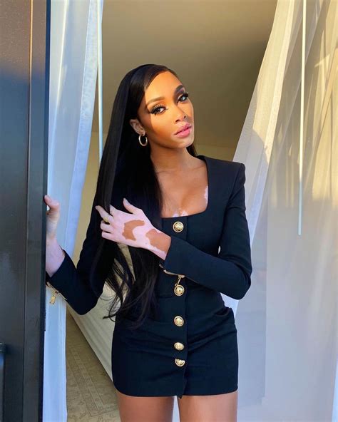 Winnie Harlow Sexy In Tiny Black Dress Photos The Fappening