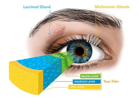 Suffering From Dry Eyes You May Have Meibomian Gland Dysfunction