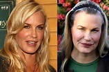 Daryl Hannah before and after plastic surgery 01 – Celebrity plastic ...
