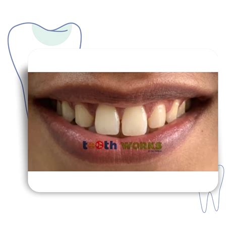 Toothworks