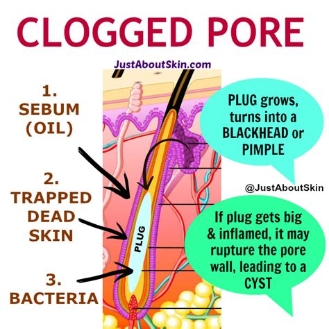 How To Minimize Clogged Pores Just About Skin