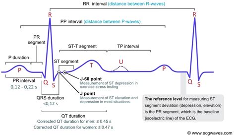 Ecg Interpretation Characteristics Of The Normal Ecg P Wave Qrs