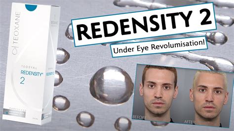 Redensity 2 For Under Eye Revolumisation Youtube