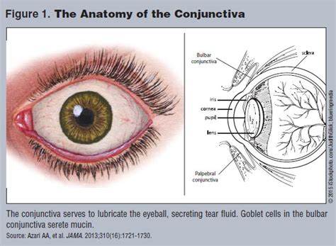 Management Of Pediatric Conjunctivitis And Otitisconjunctivitis