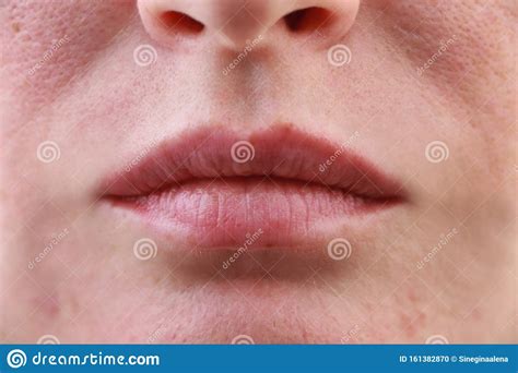 Expanded Pores Acne Comedones Black Spots Lips Close Up Problem