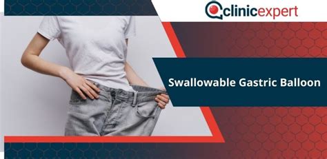 Swallowable Gastric Balloon Clinicexpert