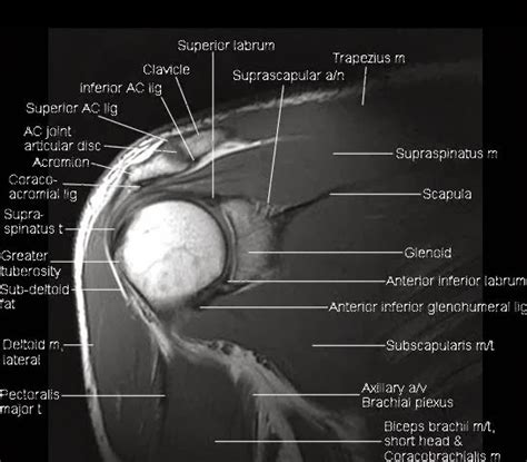Radiology Anatomy Images Mri Shoulder Anatomy