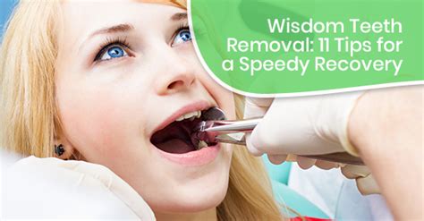 Wisdom Teeth Removal 11 Tips For A Speedy Recovery