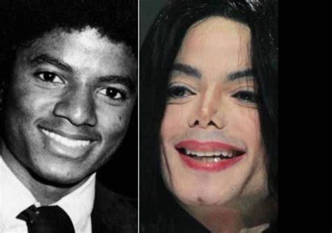 Michael Jackson Before And After Plastic Surgery 03 Celebrity Plastic