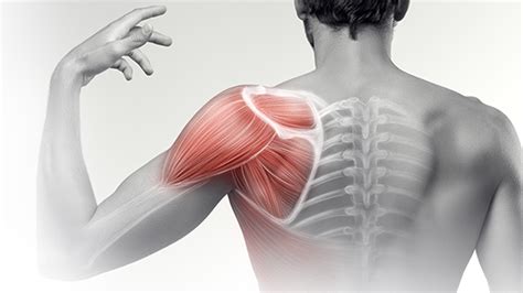 Shoulder Pain Causes Symptoms And Treatment Airrosti