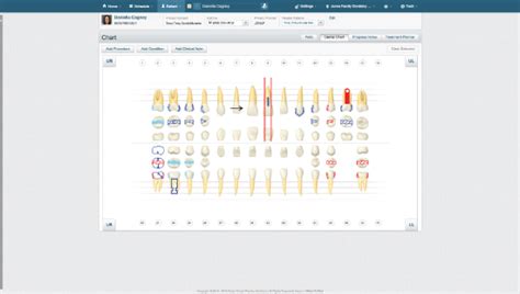 Dental Charting And Imaging Software Dentrix Ascend