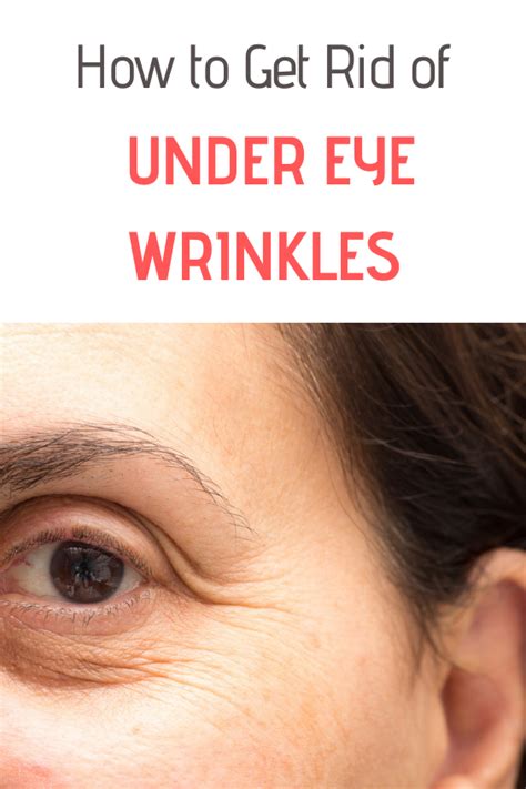 How To Get Rid Of Under Eye Wrinkles Best Tips And Tricks Under Eye