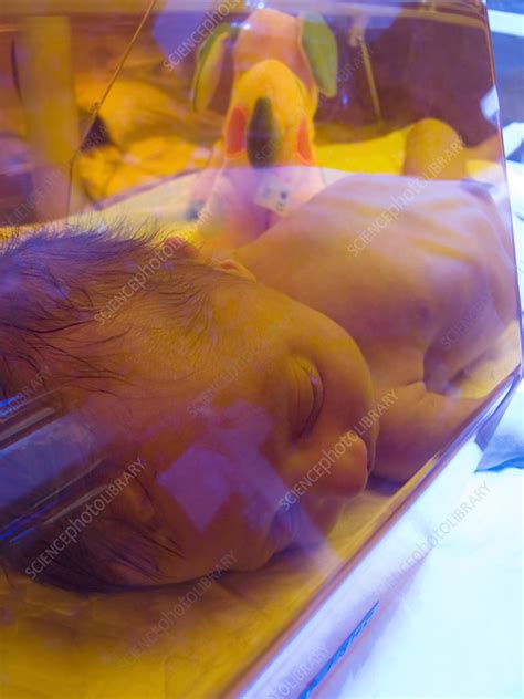 Neonatal Jaundice Light Treatment Stock Image M8200590 Science