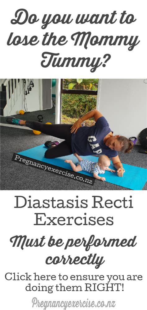 Diastasis Recti Exercises How To Perform Correctly Pregnancy Exercise