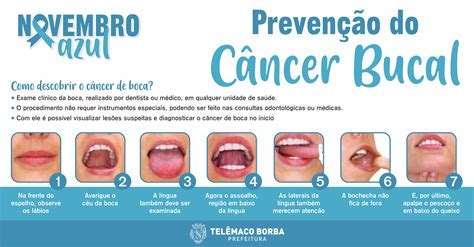 Campanha Novembro Azul Inclui Preven O Ao C Ncer De Boca Prefeitura De Tel Maco Borba