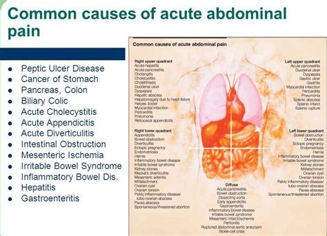 Pin On Medicine Cheat Sheet