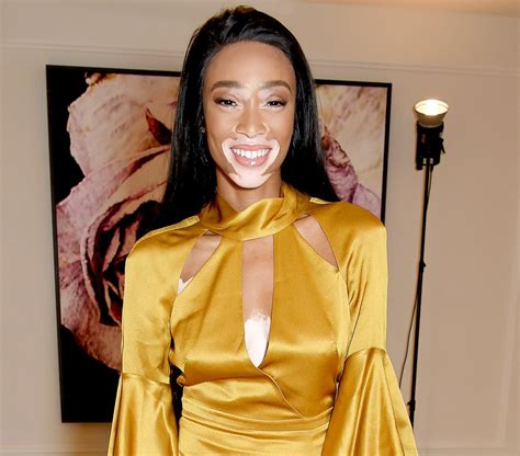 Model Winnie Harlow Strips Down For A Nearly Naked Selfie Us Weekly