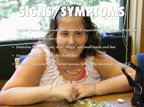 prader willi syndrome by cayla daniels