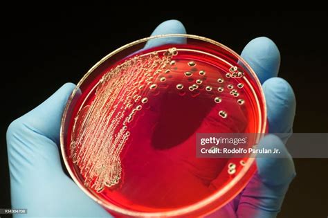 Salmonella Colonies Growing On Xld Agar Plate High Res Stock Photo