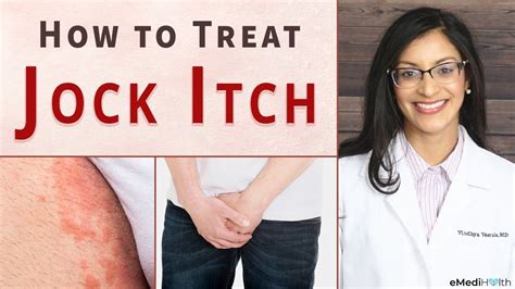Jock Itch Types