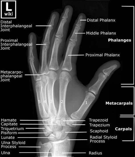 Radiographic Anatomy Hand Oblique Radiographic Anatomy