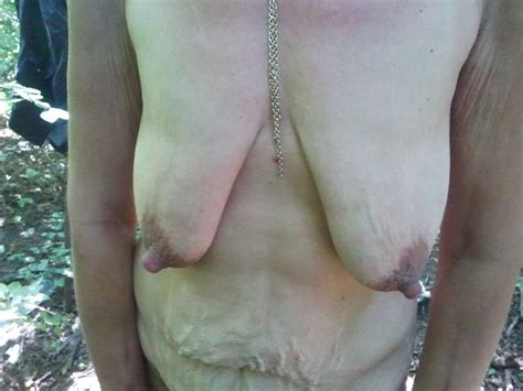 Ugly Homeless Granny In Forest Pics Xhamster