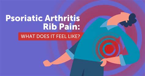 Psoriatic Arthritis Rib Pain What Does It Feel Like Mypsoriasisteam