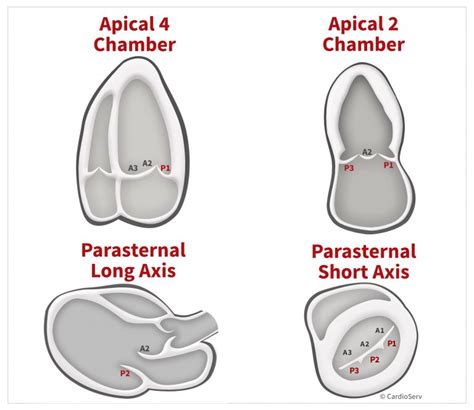 By The End Of This Blog We Hope That You Can Know The 4 Standard Views