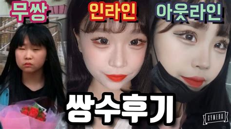 3 november 20203 november 2020 jym jym 0 comments. 두팔이의 쌍수과정/재수술/인라인 아웃라인/쌍수후기/과거사진 ...