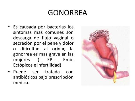 Enfermedades De Transmision Sexual Ets