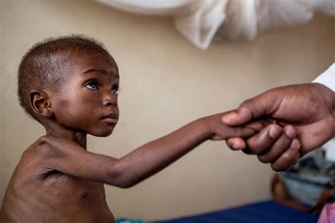 Hiv Diagnosis Struggles In Congo Unicef Usa