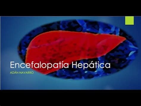 Encefalopatía Hepática Síntomas Tratamiento Etapas Enfermedades 2023