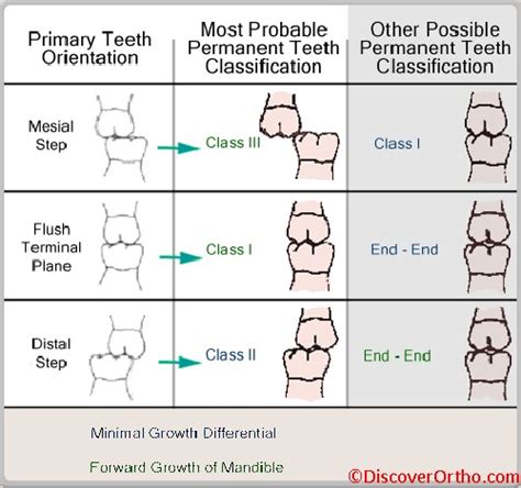 Step 2 preoperative planning for the best outcome. Student in 2.0: Mesial Step Occlusion
