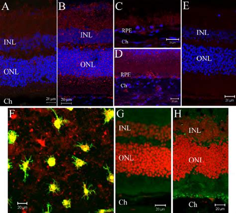 Oxidative Stress And Para Inflammation In The Aging Retina Xu Et Al Download Scientific