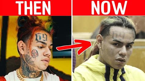 Rapper 6ix9ine Has Tattoos Removed After Joining Witness Protection