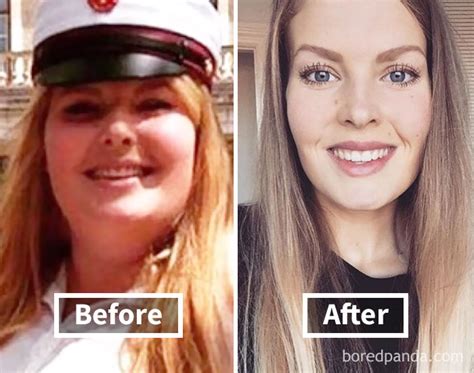 Explore The Remarkable Transformation 128 Astonishing Before And After Pictures Unveil The Impact