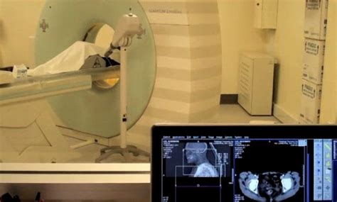 X Ray Computed Tomographynursing Care Plan Nursing Pedia