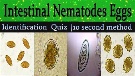 Intestinal Nematodes Eggs Identification Training Quiz With Clear