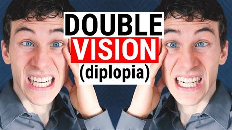 What Causes Double Vision Diplopia 5 Common Causes For Diplopia