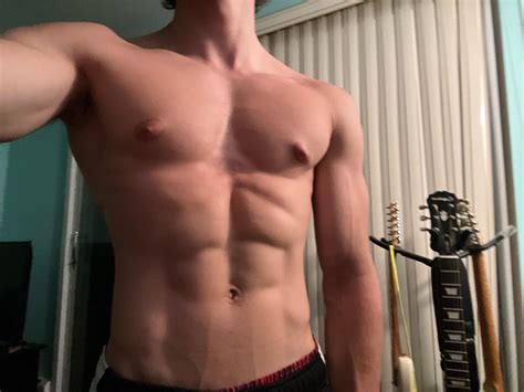 898 Best R Gynecomastia Images On Pholder 1 Year Post Surgery Results